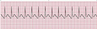 EKG - normal rhythm